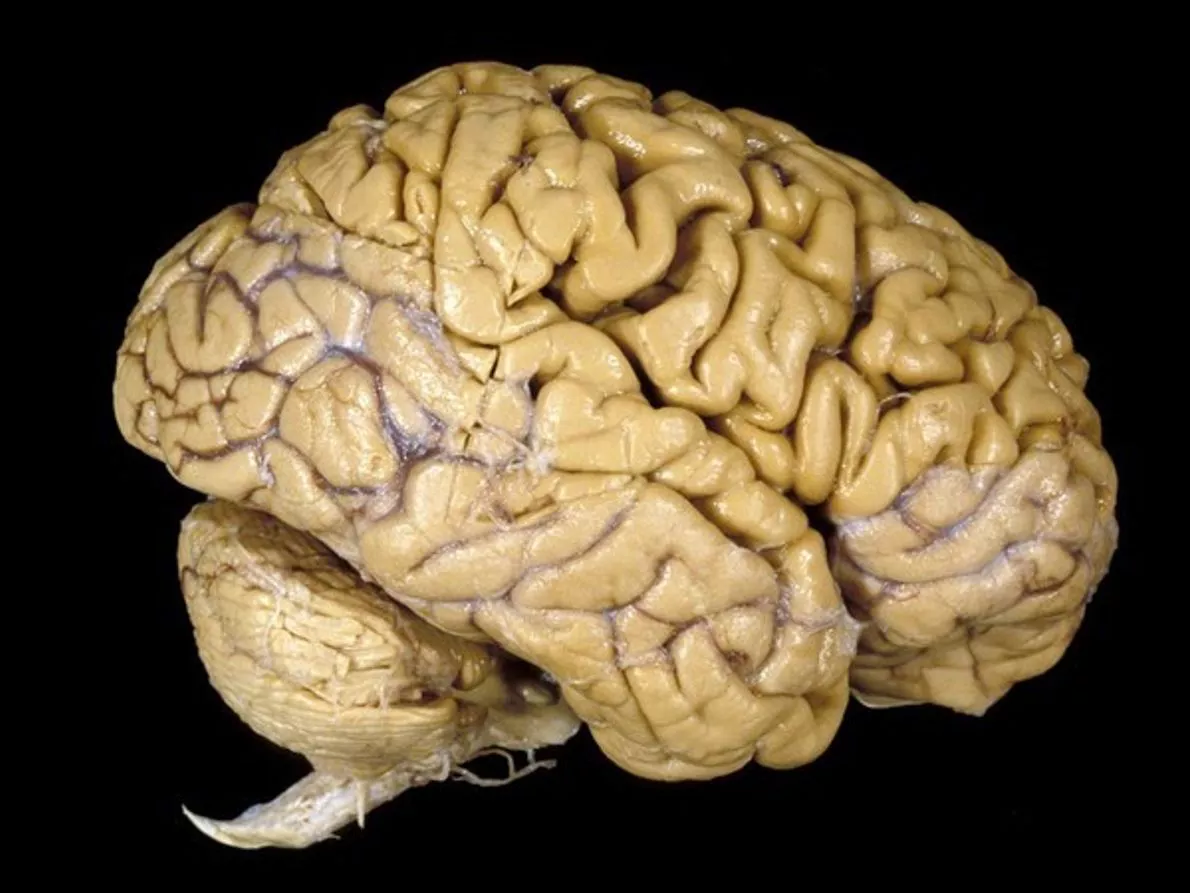 cerebro